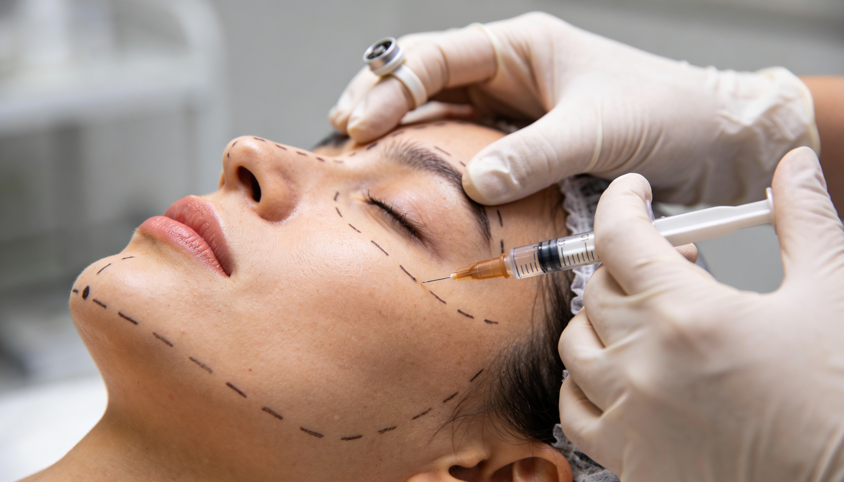 Face Basics - Harmonização Facial